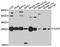 Caseinolytic Mitochondrial Matrix Peptidase Proteolytic Subunit antibody, A9127, ABclonal Technology, Western Blot image 