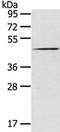 Vacuole Membrane Protein 1 antibody, TA351822, Origene, Western Blot image 