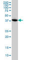 MAPK Activated Protein Kinase 3 antibody, LS-C133527, Lifespan Biosciences, Western Blot image 