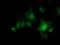 PKA regulatory subunit I beta antibody, NBP2-00634, Novus Biologicals, Immunofluorescence image 