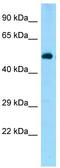 Zinc Finger And BTB Domain Containing 44 antibody, TA343720, Origene, Western Blot image 