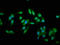 Troponin T2, Cardiac Type antibody, LS-C211523, Lifespan Biosciences, Immunofluorescence image 
