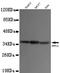 Protein Phosphatase 1 Catalytic Subunit Alpha antibody, STJ99090, St John