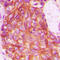 Atypical Chemokine Receptor 3 antibody, LS-C353514, Lifespan Biosciences, Immunohistochemistry paraffin image 