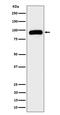 Transient Receptor Potential Cation Channel Subfamily V Member 5 antibody, M03218, Boster Biological Technology, Western Blot image 