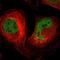 Sarcoma antigen 1 antibody, PA5-51802, Invitrogen Antibodies, Immunofluorescence image 