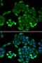 6-Pyruvoyltetrahydropterin Synthase antibody, LS-C334626, Lifespan Biosciences, Immunofluorescence image 
