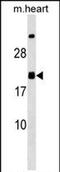 Mediator Complex Subunit 9 antibody, PA5-72064, Invitrogen Antibodies, Western Blot image 
