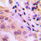 WNK1 antibody, LS-C358395, Lifespan Biosciences, Immunohistochemistry paraffin image 