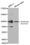 Androgen Receptor antibody, AHP2430, Bio-Rad (formerly AbD Serotec) , Western Blot image 
