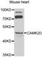 Calcium/Calmodulin Dependent Protein Kinase II Delta antibody, abx006913, Abbexa, Western Blot image 
