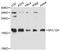 Myosin regulatory light chain 12A antibody, STJ113619, St John