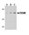 ANTXR Cell Adhesion Molecule 1 antibody, ab21270, Abcam, Western Blot image 