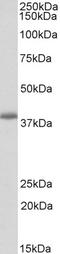 PDZ and LIM domain protein 2 antibody, STJ72922, St John