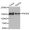 Phosphoinositide-3-Kinase Regulatory Subunit 4 antibody, abx003537, Abbexa, Western Blot image 