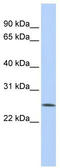 F-Box Protein 22 antibody, TA334442, Origene, Western Blot image 
