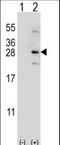 NADH dehydrogenase [ubiquinone] iron-sulfur protein 4, mitochondrial antibody, LS-C164813, Lifespan Biosciences, Western Blot image 