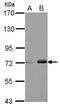 Fermitin family homolog 3 antibody, PA5-30847, Invitrogen Antibodies, Western Blot image 