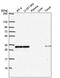 Lysosomal Associated Membrane Protein Family Member 5 antibody, PA5-67125, Invitrogen Antibodies, Western Blot image 