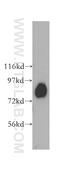 Aconitase antibody, 11134-1-AP, Proteintech Group, Western Blot image 
