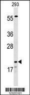 Claudin-8 antibody, 63-844, ProSci, Western Blot image 