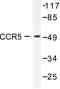 C-C Motif Chemokine Receptor 5 (Gene/Pseudogene) antibody, AP06378PU-N, Origene, Western Blot image 