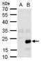 GAIP antibody, GTX129456, GeneTex, Western Blot image 