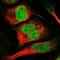 Chromosome 9 Open Reading Frame 78 antibody, NBP1-83170, Novus Biologicals, Immunofluorescence image 
