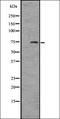 Interleukin 12 Receptor Subunit Beta 1 antibody, orb335318, Biorbyt, Western Blot image 