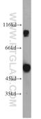 Calcium Binding Tyrosine Phosphorylation Regulated antibody, 12351-1-AP, Proteintech Group, Western Blot image 