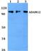 ADAM Metallopeptidase Domain 12 antibody, PA5-75796, Invitrogen Antibodies, Western Blot image 