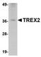 Three Prime Repair Exonuclease 2 antibody, NBP1-76978, Novus Biologicals, Western Blot image 
