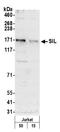 SCL-interrupting locus protein antibody, A302-441A, Bethyl Labs, Western Blot image 