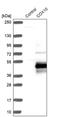 Cytochrome C Oxidase Assembly Factor Heme A:Farnesyltransferase COX10 antibody, PA5-56899, Invitrogen Antibodies, Western Blot image 