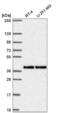Mitochondrial Fission Regulator 1 antibody, NBP2-55309, Novus Biologicals, Western Blot image 