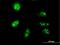 TP53 Regulating Kinase antibody, H00112858-M05, Novus Biologicals, Immunocytochemistry image 