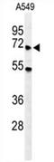 YTH N6-Methyladenosine RNA Binding Protein 3 antibody, AP54605PU-N, Origene, Western Blot image 