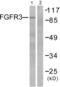 Fibroblast Growth Factor Receptor 3 antibody, abx013077, Abbexa, Western Blot image 