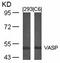 Vasodilator Stimulated Phosphoprotein antibody, orb14567, Biorbyt, Western Blot image 