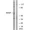 Arylsulfatase F antibody, A14632, Boster Biological Technology, Western Blot image 