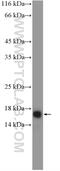 Cathelicidin Antimicrobial Peptide antibody, 12009-1-AP, Proteintech Group, Western Blot image 