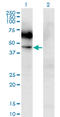 Colony Stimulating Factor 2 Receptor Alpha Subunit antibody, LS-C196981, Lifespan Biosciences, Western Blot image 