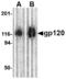 HIV gp120 antibody, LS-C53316, Lifespan Biosciences, Western Blot image 