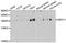 ATP Binding Cassette Subfamily C Member 1 antibody, STJ22459, St John