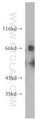 SLC22A2 antibody, 13594-1-AP, Proteintech Group, Western Blot image 
