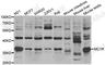 Melanocortin 1 Receptor antibody, A3009, ABclonal Technology, Western Blot image 