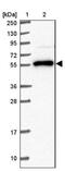 NACC Family Member 2 antibody, NBP2-30579, Novus Biologicals, Western Blot image 