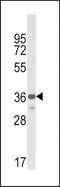 MHC Class I Polypeptide-Related Sequence A antibody, TA325054, Origene, Western Blot image 