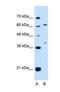 Interferon Lambda Receptor 1 antibody, NBP1-69636, Novus Biologicals, Western Blot image 