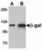 E. coli Beta Galactosidase antibody, LS-C108511, Lifespan Biosciences, Western Blot image 
